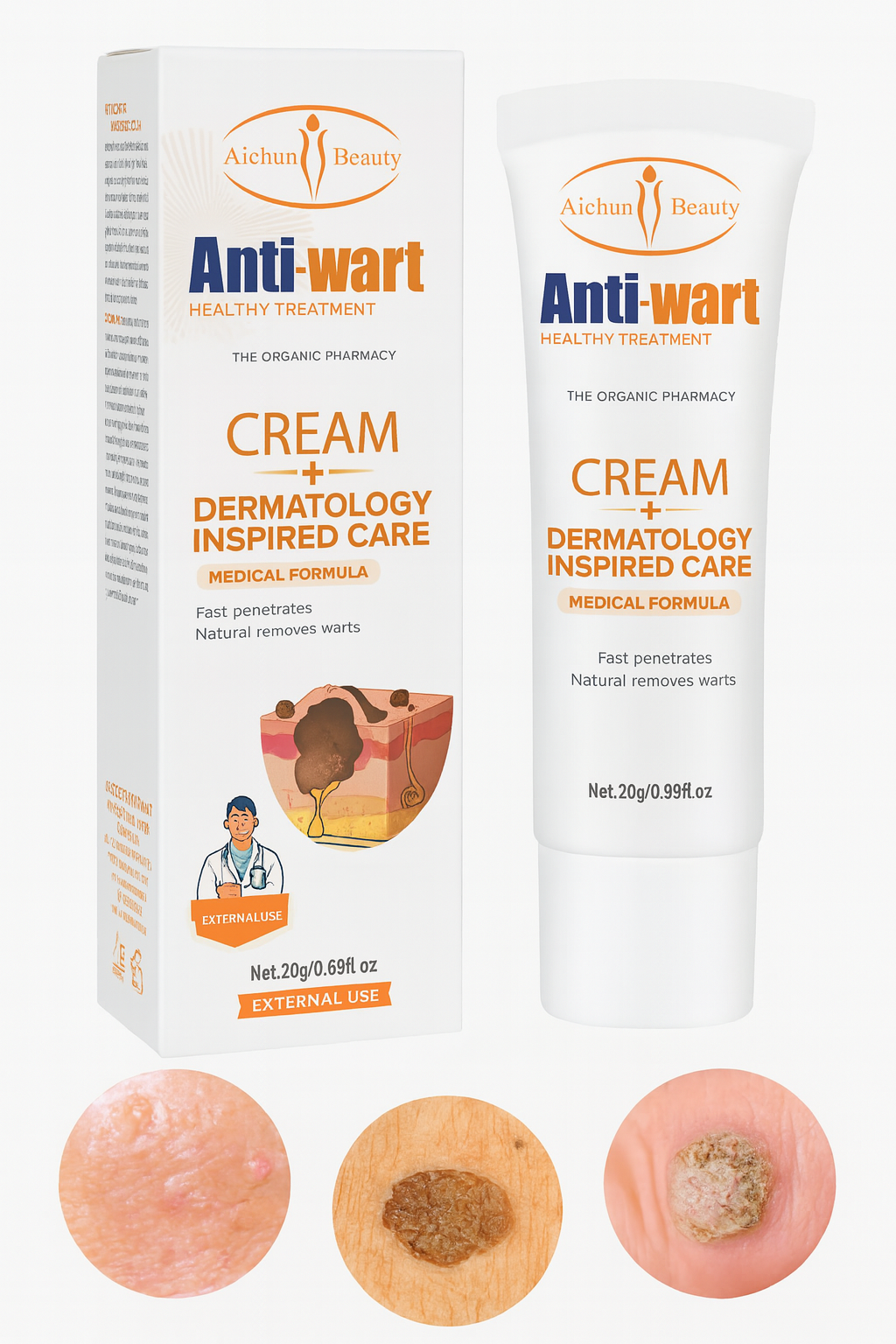 Crema Removedora de Verrugas